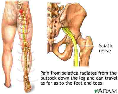 drawing of sciatic nerve path